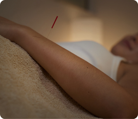 Person lying down with an acupuncture needle in their forearm, a classic TCM treatment.